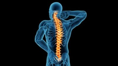 Mielite Transversa: Fisiopatologia, Desafios Diagnósticos e Potencial Terapêutico da Cannabis Medicinal